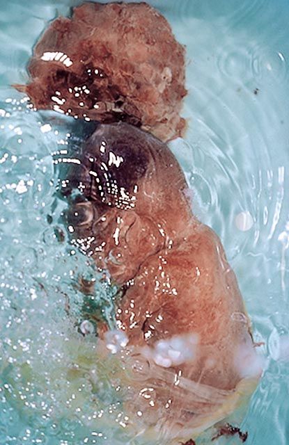 Китайский деликатес из эмбриона