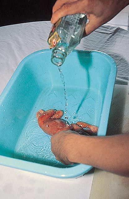 Китайский деликатес из эмбриона