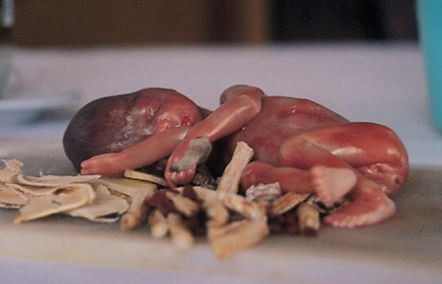 Китайский деликатес из эмбриона